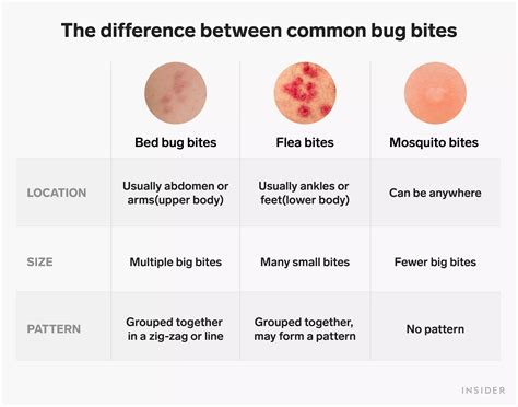 How to identify and treat bed bug bites | Business Insider India