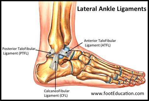 Sprained Ankle | footEducation | Sprained ankle, Foot injury, Bones of ...