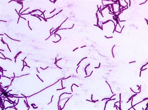 Bacillus Coagulans Gram Stain