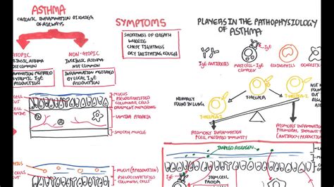 Asthma - signs and symptoms, pathophysiology - YouTube