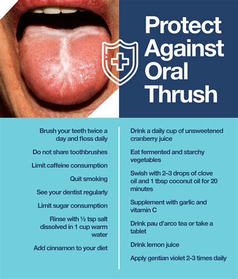 How to Treat Oral Thrush: Beware of These Symptoms! – The Amino Company