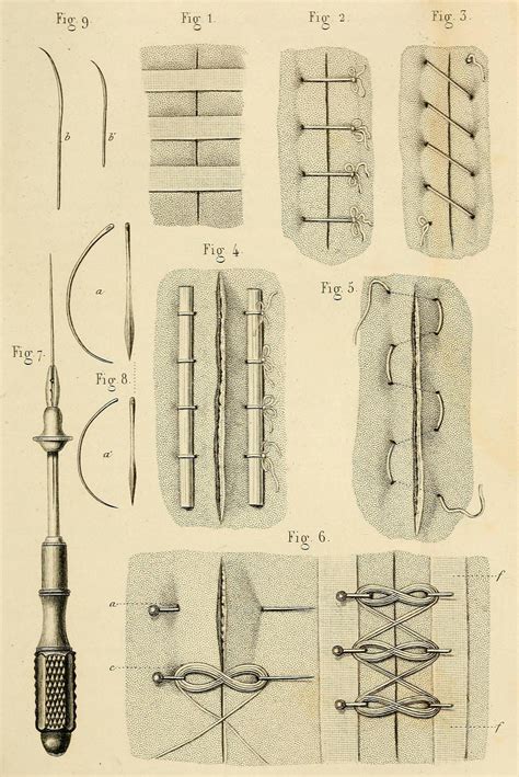 share it Biomedical Ephemera, or: A Frog for Your Boils Hi-res 6,246 notes