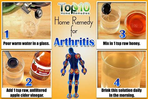 Home Remedies for Arthritis | Top 10 Home Remedies