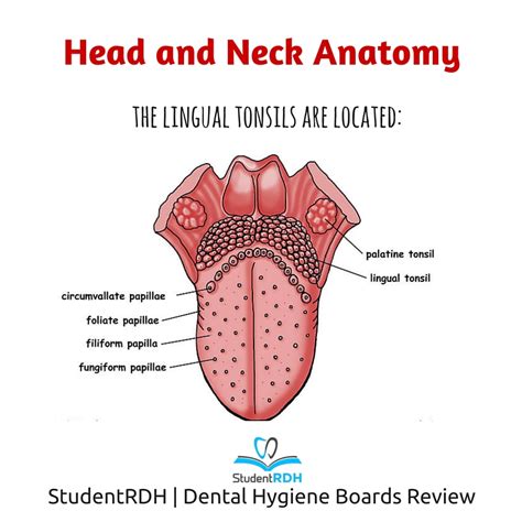 Q: Where are the lingual tonsils located? - StudentRDH Blog