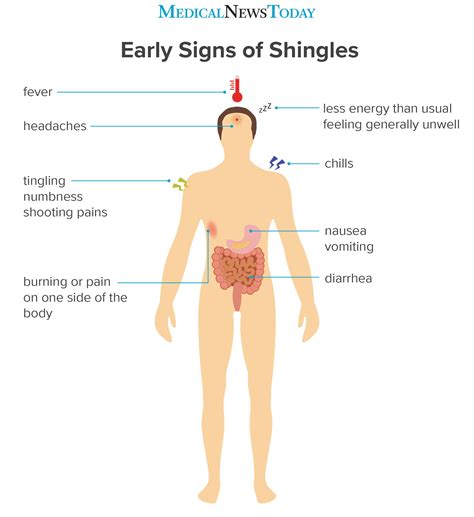 The early stages of shingles: Signs and symptoms