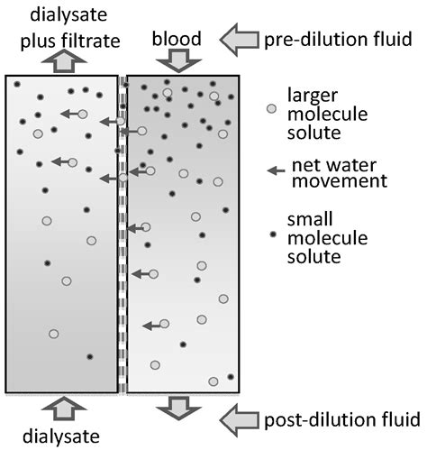 Principles and Practices of Haemodiafiltration | IntechOpen