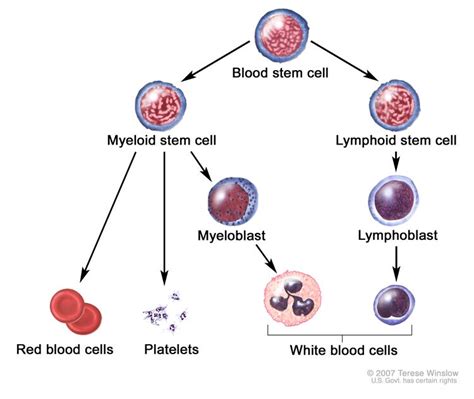 Acute Leukemia Cells