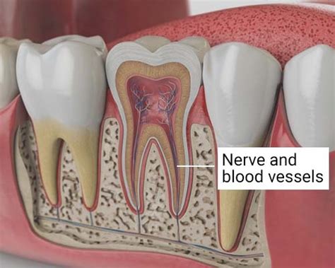 Tooth Nerve Pain Relief Therapy in the Bronx, NY