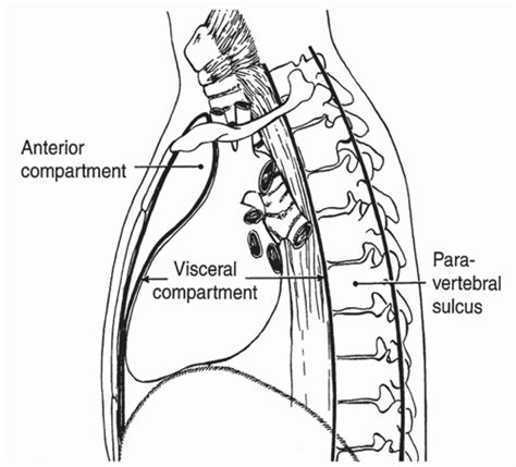 Diagnostic Evaluation of Anterior Mediastinal Masses and Clinical and ...