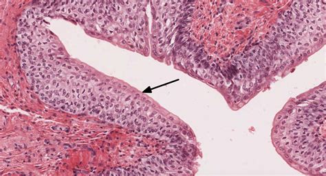 Epithelial Tissue | histology