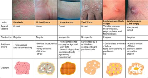 Pin on MSK/Dermatology