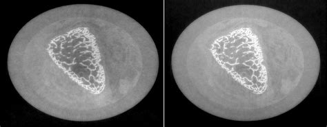 X-Ray Phase-Contrast (XPC) Imaging and Tomography – Computational ...