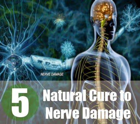 5 Natural Cure For Nerve Damage ~ Mzizi Mkavu