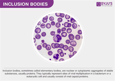 Inclusion bodies - Features & Classifications Of Inclusion Bodies