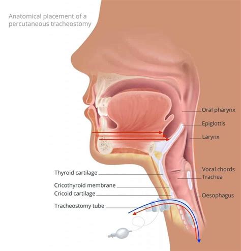 What Is Tracheostomy? Basics Of Breathing, Indications, Procedures And ...