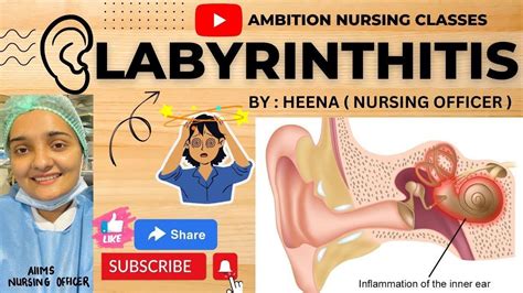 Labyrinthitis | Definition | Etiology | Pathophysiology | Symptoms ...