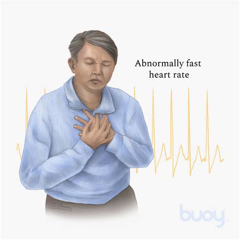 Heart palpitations and mitral valve facial – Telegraph