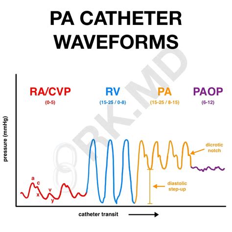 Pulmonary Artery Catheter/Swan-Ganz Structure And Waveforms | RK.MD