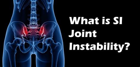 What is SI Joint Instability? Sacroiliac Joint Instability..