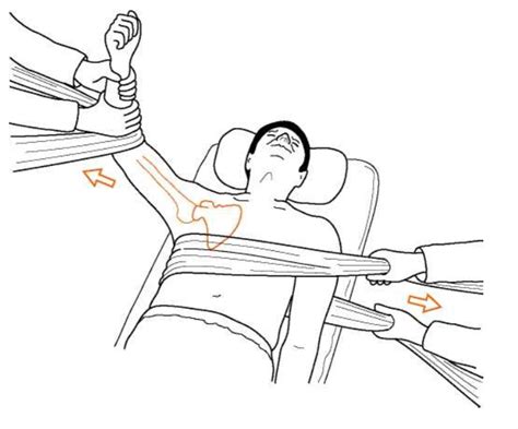 SHOULDER DISLOCATION,SOME REDUCTION METHODS