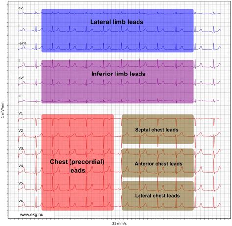 The ECG leads: Electrodes, limb leads, chest (precordial) leads and the ...