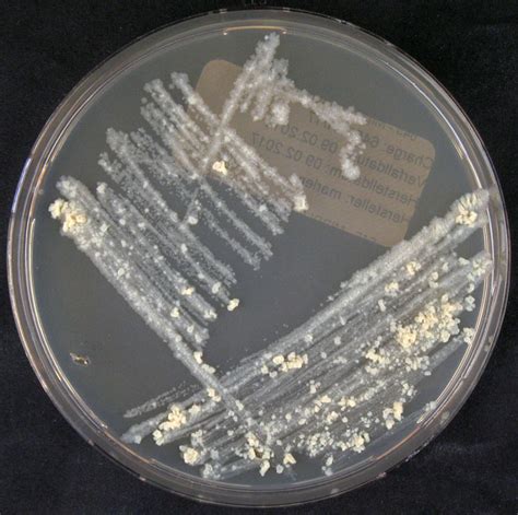 Mycobacterium Tuberculosis Culture