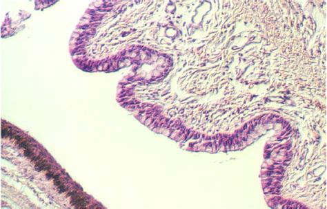 Pathology Outlines - Anatomy & histology-conjunctiva