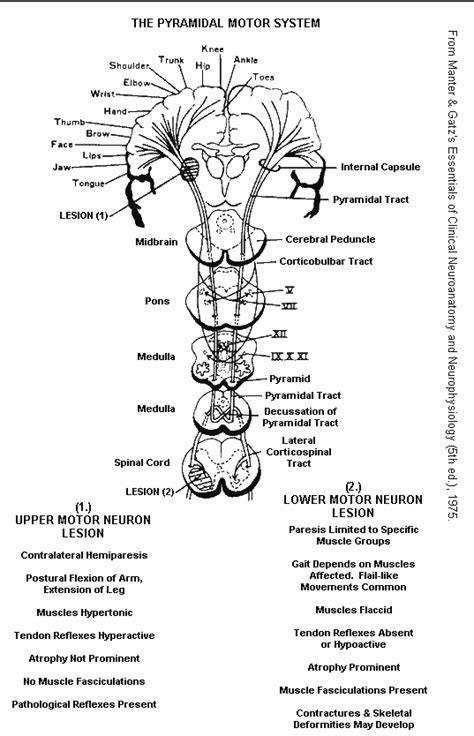 Causes, symptoms and treatment of Extrapyramidal side effects of ...