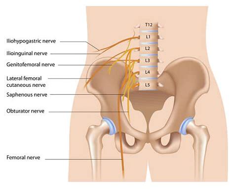 Iliohypogastric Nerve Pain