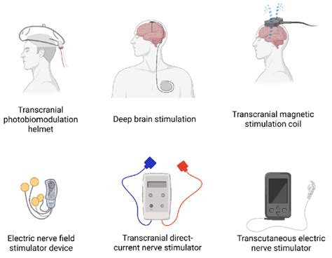 Examples of neurostimulation devices. | Download Scientific Diagram