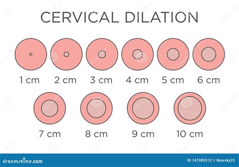 Cervical Dilatation Chart