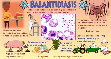 Pathology of Balantidiasis (Balantidium Coli) - Dr Sampurna Roy MD