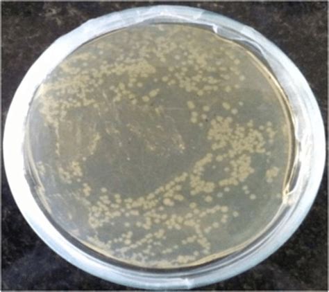 Agar plate showing growth of Escherichia coli bacterial colonies ...