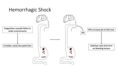 Classes Of Hemorrhagic Shock : PPT - Shock PowerPoint Presentation ...