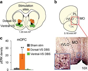 Deep brain stimulation (DBS) of dorsal–ventral striatum (VS) increases...