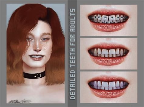 Sims 4 Teeth and Lip CC & Mods (Alpha & Maxis Match) — SNOOTYSIMS