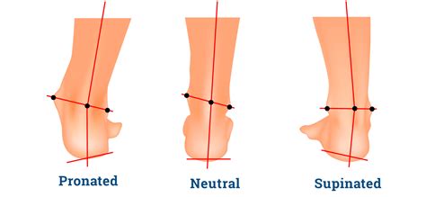 Know Your Arches - ShoeInsoles.co.uk