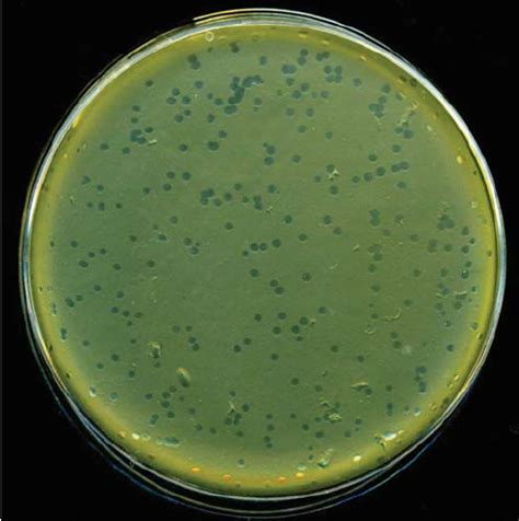 Bacterial Plaque