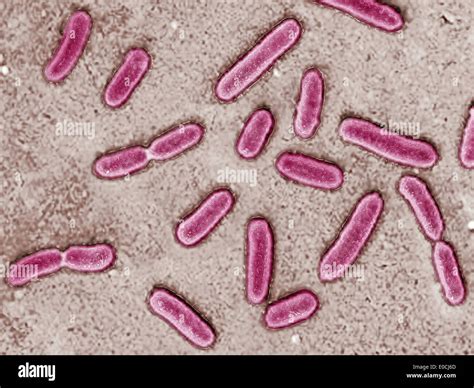 Pseudomonas Aeruginosa Gram Stain 1000x