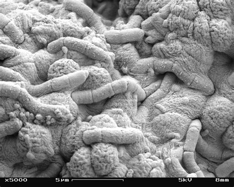 File:Algae and bacteria in Scanning Electron Microscope, magnification ...