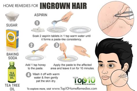 Home Remedies for Ingrown Hair | Top 10 Home Remedies