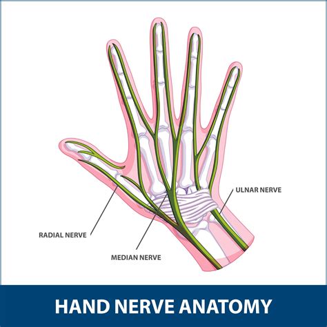 Hand Nerve Decompression | Florida Orthopaedic Institute