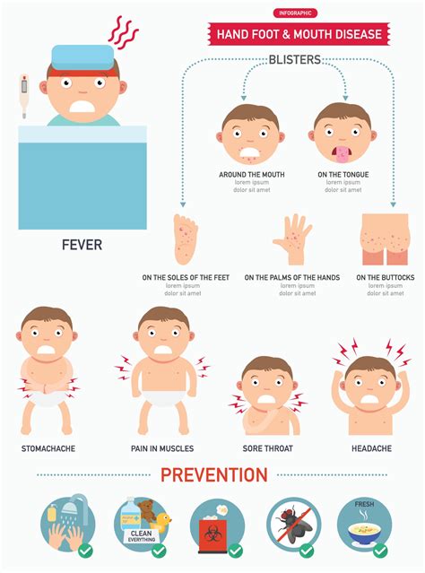 Hand Foot And Mouth Disease Infographic