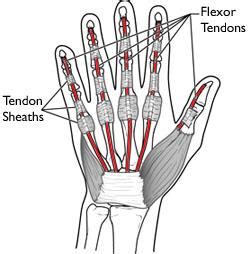 Flexor Tendon Injuries - Mendelson Kornblum