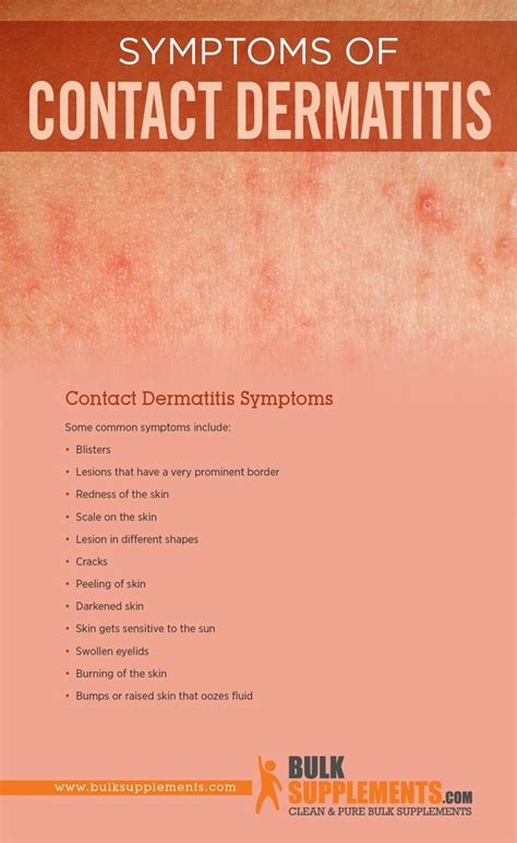 Contact Dermatitis: Symptoms, Causes & Treatment