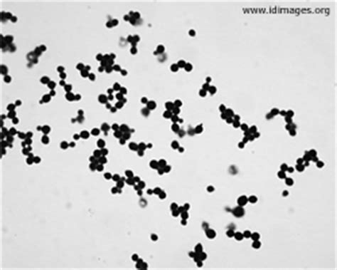 Cryptococcus Images - Infectious Disease Images - eMicrobes Digital ...