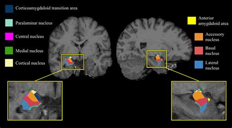 Amygdala And Hypothalamus Mri