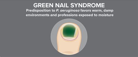 Pseudomonas aeruginosa Test for Green Nail Syndrome - Cutis Diagnostics