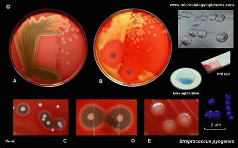 Streptococcus pyogenes, Group A streptococcus(GAS), Group A Strep: the ...