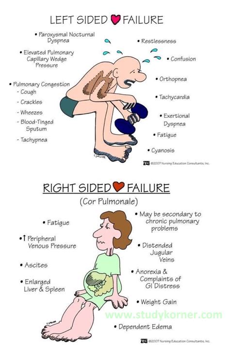 Nursing Left Sided Heart Failure - StudyPK